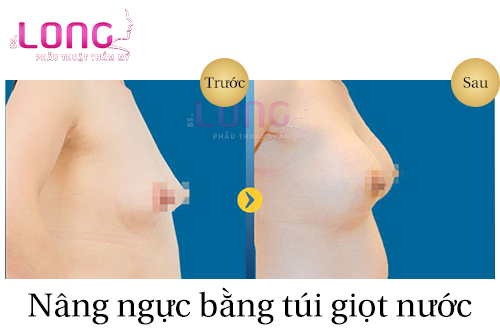 nang-nguc-bang-tui-giot-nuoc-co-an-toan-khong-1