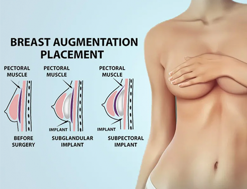 nâng ngực bác sĩ nào an toàn